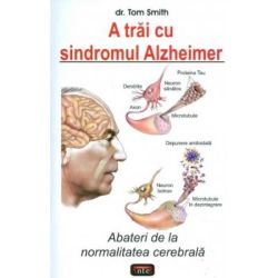 A trai cu sindromul Alzheimer