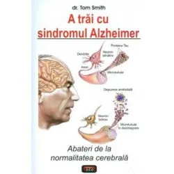 A trai cu sindromul Alzheimer de Tom Smith