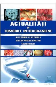 Actualitati in tumorile intracraniene de Stefan Mircea Iencean