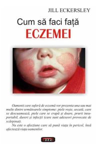 Cum sa faci fata eczemei