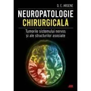 Neuropatologie chirurgicala. Tumorile sistemului nervos si ale structurilor asociate de Dr. Dorel Eugen Arsene