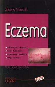Eczema
