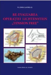 Re-evaluarea operatiei Lichtenstein „tension free” de Florin Gavrilas