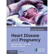 Heart Disease and Pregnancy de Philip J. Steer