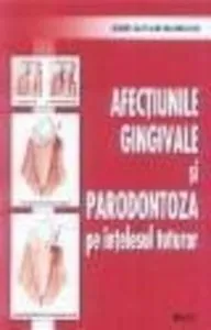 Afectiunile gingivale si parodontoza pe intelesul tuturor de Nouri Davijani Mahnsoush