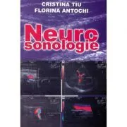 Neurosonologie de Cristina Tiu