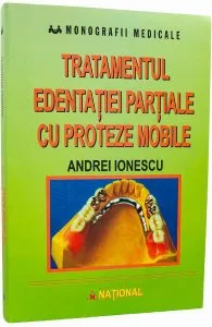 Tratamentul edentatiei partiale cu proteze mobile de Andrei Ionescu