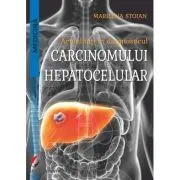 Actualitati in diagnosticul carcinomului hepatocelular de Marilena Stoian