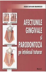 Afectiunile gingivale si paradontoza pe intelesul tuturor