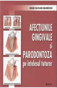Afectiunile gingivale si paradontoza pe intelesul tuturor de Nouri Davijani Mahnoush