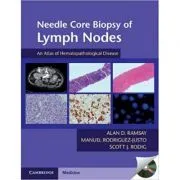 Needle Core Biopsy of Lymph Nodes with DVD-ROM: An Atlas of Hematopathological Disease de Alan D. Ramsay