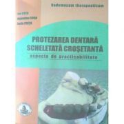 Protezarea dentara scheletata crosetanta. Practibilitate