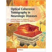 Optical Coherence Tomography in Neurologic Diseases