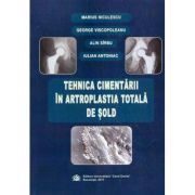 Tehnica cimentarii in artroplastia totala de sold
