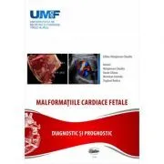 Malformatii cardiace fetale de Claudiu Marginean