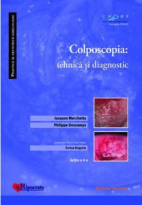 Colposcopia: tehnica si diagnostic