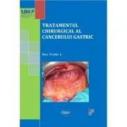 Tratamentul chirurgical al cancerului gastric. Color de Tivadar Bara