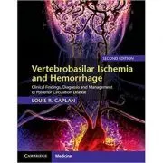Vertebrobasilar Ischemia and Hemorrhage: Clinical Findings, Diagnosis and Management of Posterior Circulation Disease de Louis R. Caplan