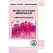 Acantoliza in bolile dermatologice de Marian Costache