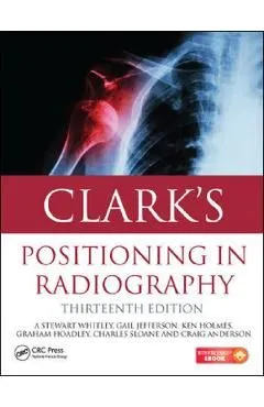 Clark's Positioning in Radiography de Gail Jefferson