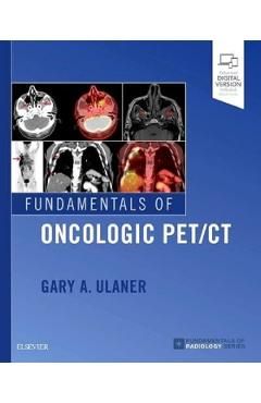 Fundamentals of Oncologic PET/CT