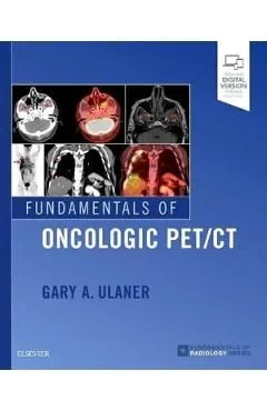 Fundamentals of Oncologic PET/CT de Gary Ulaner