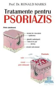 Tratamente pentru psoriazis de Ronald Marks