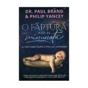 O faptura atat de minunata de Paul Brand