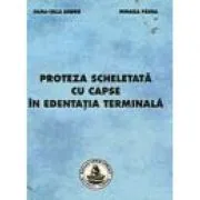 Proteza scheletata cu capse in edentatia terminala de Mihaela Pauna