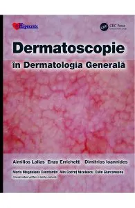 Dermatoscopie in Dermatologia Generala de Dimitrios Ioannides