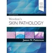 Weedon's Skin Pathology de James W. Patterson