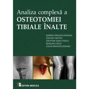 Analiza complexa a Osteotomiei Tibiale Inalte de Serban Dragosloveanu