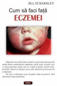 Cum sa faci fata eczemei de Jill Eckersley