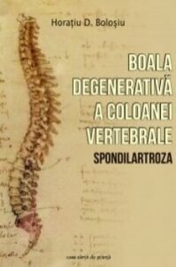 Boala degenerativa a coloanei vertebrale-Spondilartroza