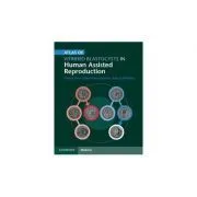 Atlas of Vitrified Blastocysts in Human Assisted Reproduction de Thomas Ebner