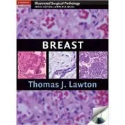 Breast de Thomas J. Lawton MD