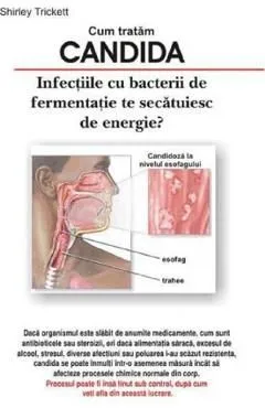 Cum tratam candida de Shitley Trickett