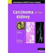 Carcinoma of the Kidney de Uday Patel