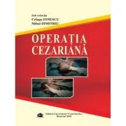 Operatia cezariana de Mihai Dimitriu
