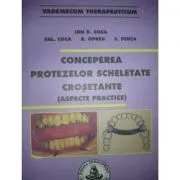 Conceperea protezelor scheletate crosetante de Ion Coca