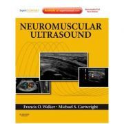 Neuromuscular Ultrasound