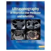 Ultrasonography in Reproductive Medicine and Infertility de Botros R. M. B. Rizk