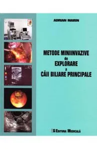 Metode miniinvazive de explorare a caii biliare principale de Adrian Marin
