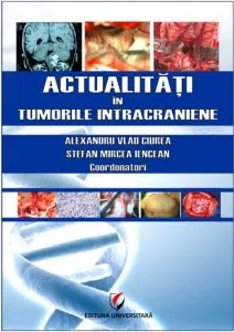 Actualitati in tumorile intracraniene de Alexandru Vlad Ciurea