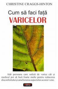 Cum sa faci fata varicelor