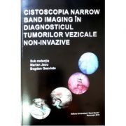 Cistoscopia narrow band imaging in diagnosticul tumorilor vezicale non-invazive