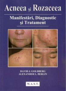 Acneea si rozaceea. Manifestari, diagnostic si tratament