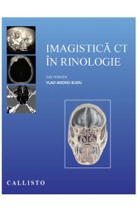Imagistica CT in rinologie
