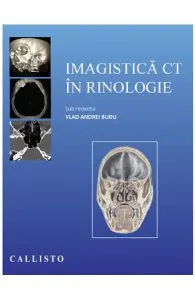 Imagistica CT in rinologie de Vlad Andrei Budu
