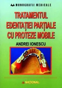 Tratamentul edentației parțiale cu proteze mobile de Andrei Ionescu